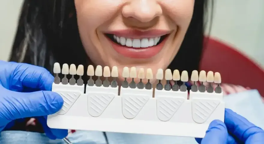 Uśmiechnięta kobieta z paletą odcieni zębów w rękach dentysty w niebieskich rękawiczkach.