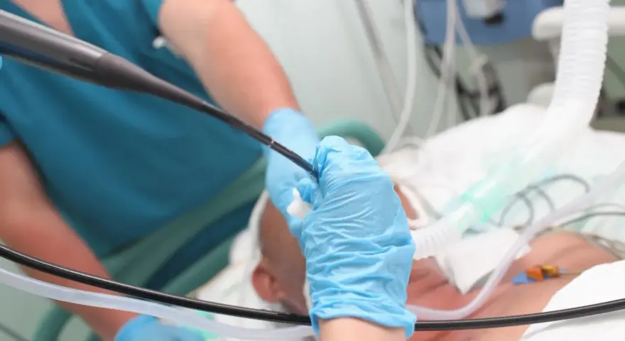 Lekarz w niebieskich rękawiczkach wykonuje bronchoskopię pacjentowi podłączonemu do respiratora.