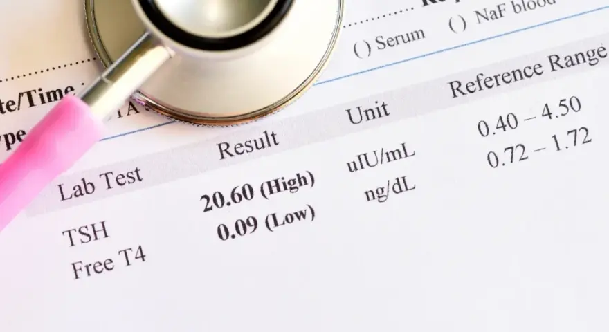 Stetoskop na wynikach badań laboratoryjnych TSH i Free T4, z zaznaczonymi wynikami wysokim i niskim.