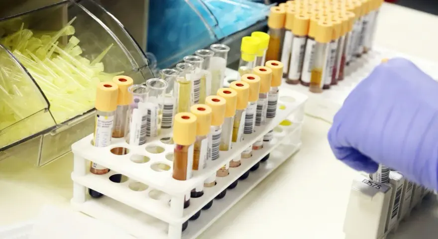 Probówki z próbkami krwi w laboratorium, ręka w rękawiczce pobiera jedną z nich.