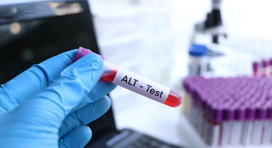 Ręka w niebieskiej rękawiczce trzyma probówkę z krwią oznaczoną "ALT - Test". W tle mikroskop i stojak z probówkami.