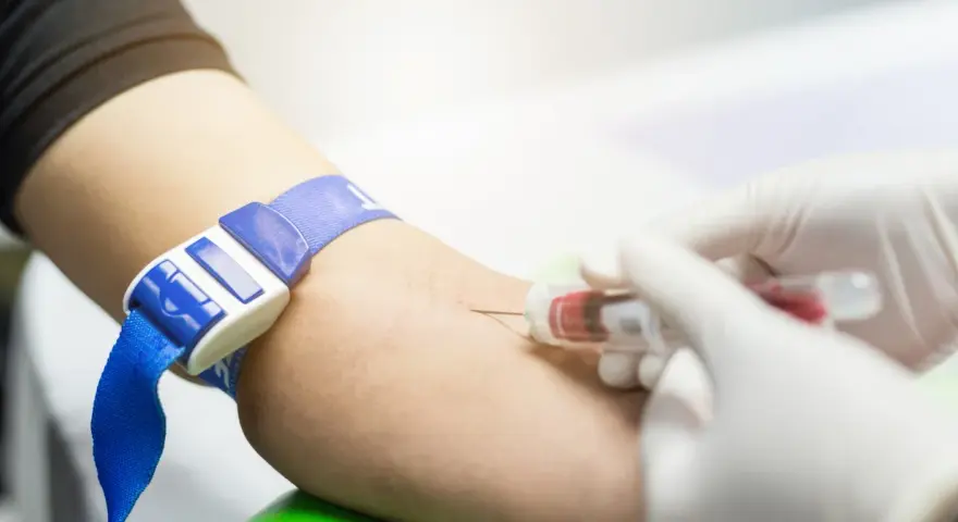 Pobieranie krwi do badań, w tym aptt. Opaska uciskowa na ramieniu, igła i probówka z krwią.