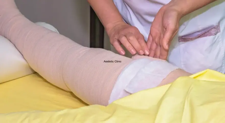 Noga owinięta bandażem kompresyjnym, ręce terapeuty.