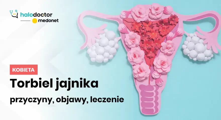 Jakie leki na torbiel jajnika? Skuteczne opcje leczenia i objawy