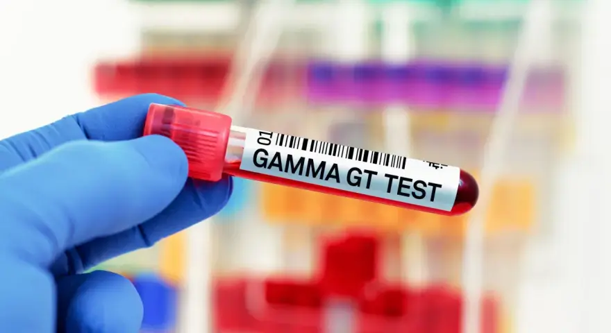 Ręka w niebieskiej rękawiczce trzyma probówkę z napisem "GAMMA GT TEST".