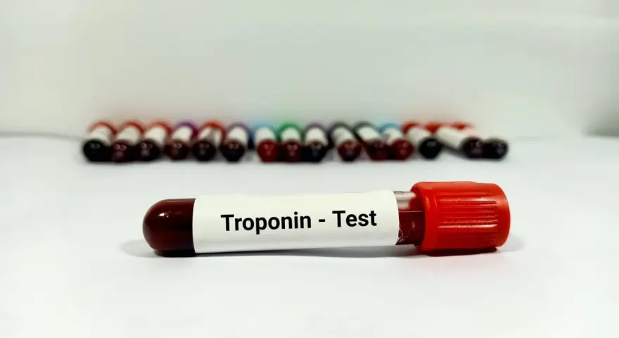 Probówka z oznaczeniem "Troponin - Test" na tle rzędu innych próbek krwi.