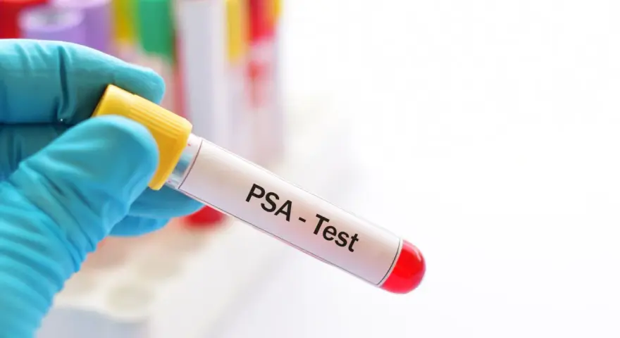 Ręka w niebieskiej rękawiczce trzyma probówkę z napisem "PSA - Test".