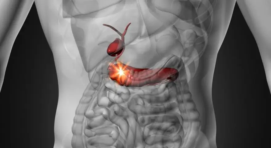 Anatomical illustration of a human torso showing a red gallbladder and pancreas with a bright light emanating from the pancreas.