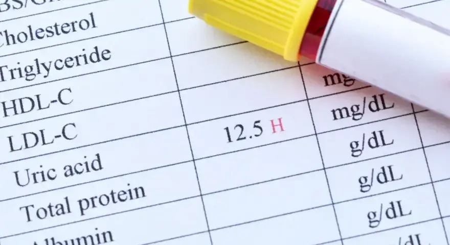 Wynik badania kwas moczowy: 12.5 H. Obok probówka z krwią.