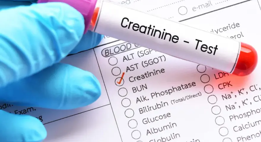Ręka w niebieskiej rękawiczce trzyma probówkę z napisem "Creatinine - Test". Obok zaznaczono "Creatinine" na formularzu badań.