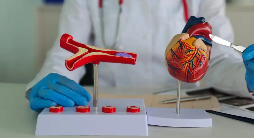 Model serca i przekrój naczynia krwionośnego z zakrzepem, prezentowane przez lekarza w białym fartuchu.