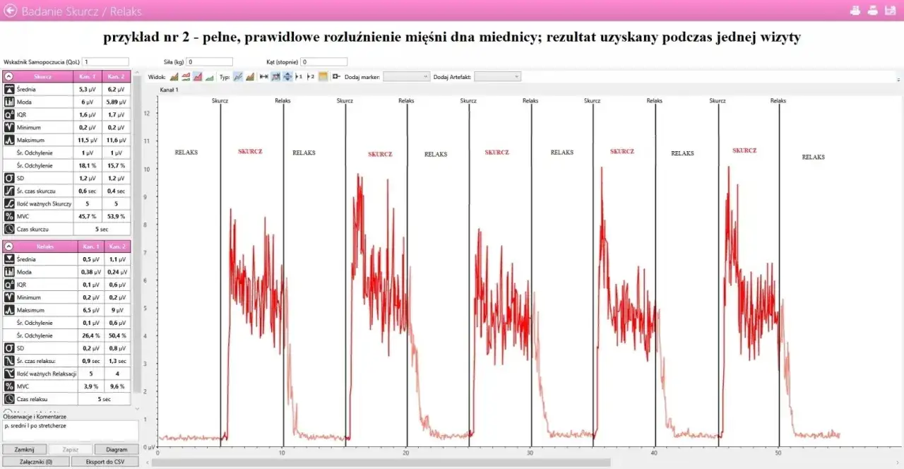 Wynik badania mięśni dna miednicy: prawidłowe rozluźnienie i skurcz. Analiza pokazuje cykle skurczu i relaksu, kluczowe dla oceny funkcji mięśni.