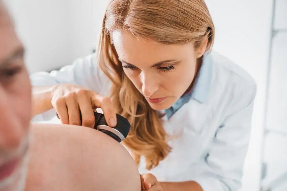 Dermatolog bada pieprzyk, sprawdzając, czy nie jest to niepokojący guz.